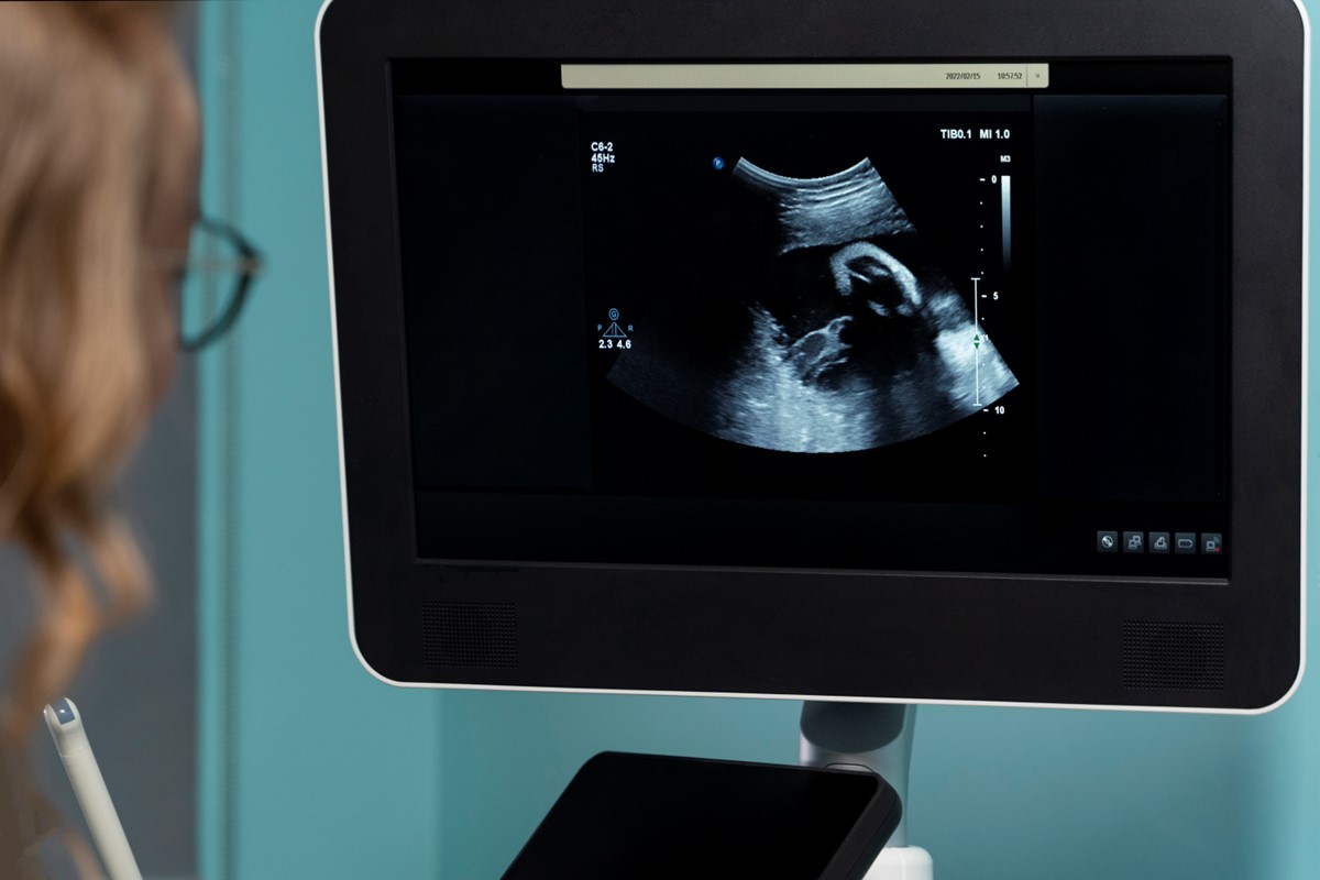 What is 3D Scan in Pregnancy? Janta diagnostic centre pvt ltd