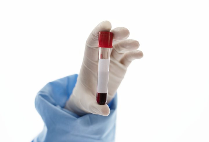 Doctor holding a blood test tube